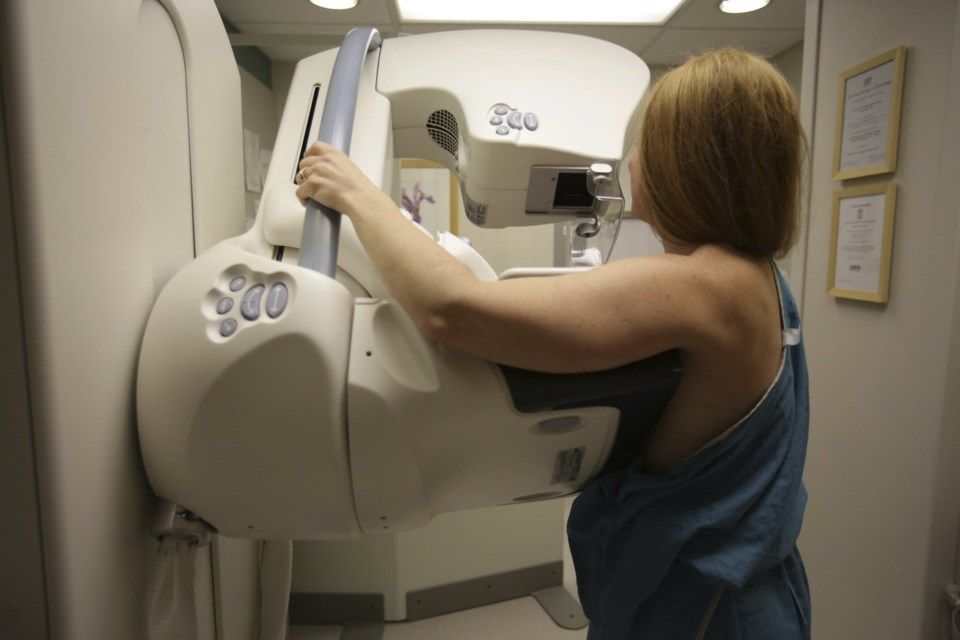 Mammogram Age Reduced to 40 Expands Access for Women